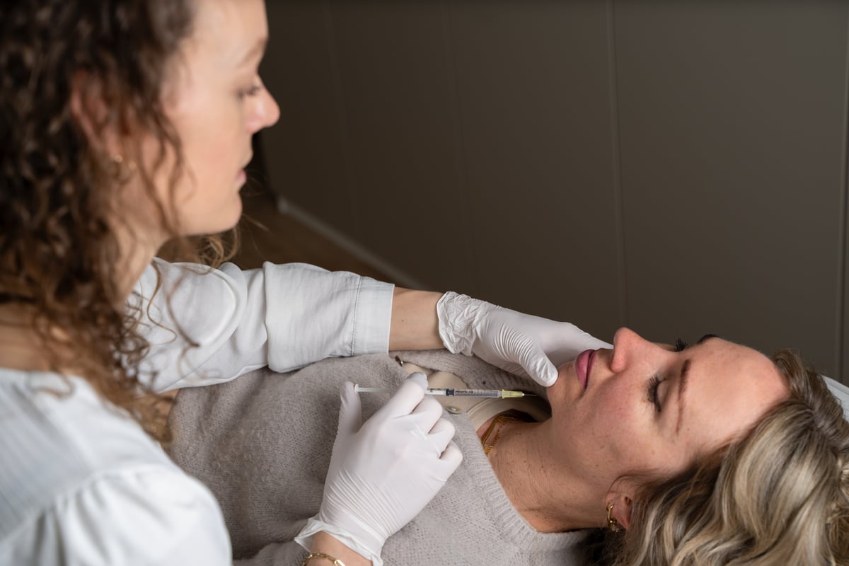 Fillers voor neuslippenplooi